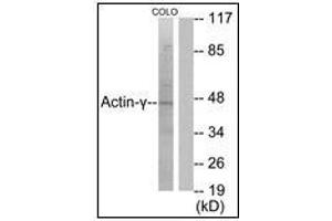 Western blot analysis of extracts from COLO205 cells, using Actin-gamma2 Antibody. (ACTG2 antibody  (N-Term))