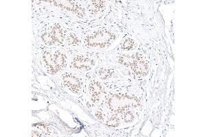 Immunohistochemistry (IHC) image for anti-Heterogeneous Nuclear Ribonucleoprotein U-Like 1 (HNRNPUL1) (C-Term) antibody (ABIN7453846)