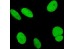 Immunofluorescence of purified MaxPab antibody to SAE1 on HeLa cell.