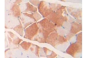 Immunohistochemistry (IHC) image for anti-Cardiac Troponin I (TNNI3) (AA 1-211) antibody (ABIN7431863)
