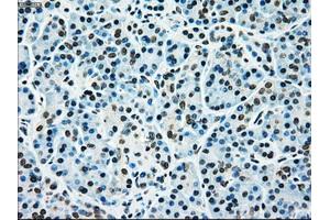 Immunohistochemical staining of paraffin-embedded liver tissue using anti-MAP2K4mouse monoclonal antibody. (MAP2K4 antibody)