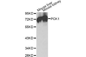 Western blot analysis of extracts of various cell lines, using PCK1 antibody (ABIN1874054). (PCK1 antibody)