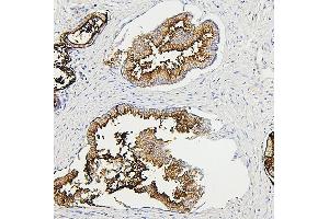 IHC analysis of RAB27A using anti-RAB27A antibody (ABIN7602714). (RAB27A antibody  (AA 98-216))