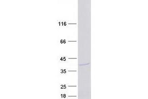 Validation with Western Blot