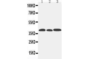 Anti-CCR5 antibody, Western blotting Lane 1: Mouse Lung Tissue Lysate Lane 2: Mouse Intestine Tissue Lysate Lane 3: Mouse Kidney Tissue Lysate (CCR5 antibody  (Middle Region))