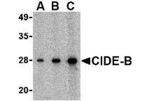 Western blot analysis of CIDE-B in mouse small intestine tissue lysate with AP30232PU-N CIDE-B antibody at (A) 0. (CIDEB antibody  (C-Term))