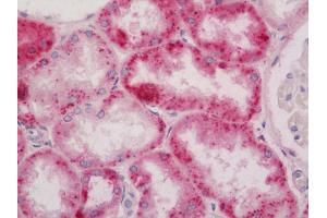 anti-Ribonuclease, RNase A Family, 2 (Liver, Eosinophil-Derived Neurotoxin) (RNASE2) antibody (FITC)