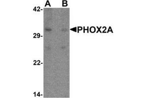 Western blot analysis of PHOX2A in rat brain tissue lysate with PHOX2A antibody at 1 ug/ml in (A) the absence and (B) the presence of blocking peptide. (PHOX2A antibody  (C-Term))