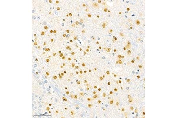 SOX1 antibody