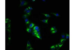 Immunofluorescence staining of Hela cells with ABIN7146107 at 1:200, counter-stained with DAPI. (CXCR4 antibody  (AA 1-356))