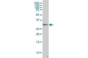 TP53RK monoclonal antibody (M02), clone 2A9 Western Blot analysis of TP53RK expression in COLO 320 HSR . (TP53RK antibody  (AA 154-253))