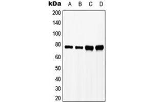 Western blot analysis of SLP76 (pY128) expression in HeLa H2O2-treated (A), Jurkat (B), Raw264. (LCP2 antibody  (pTyr128))