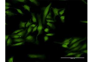 Immunofluorescence of purified MaxPab antibody to MTA1 on HeLa cell. (MTA1 antibody  (AA 1-255))