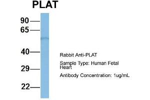 Host: Rabbit  Target Name: PLAT  Sample Tissue: Human Fetal Heart  Antibody Dilution: 1. (PLAT antibody  (Middle Region))