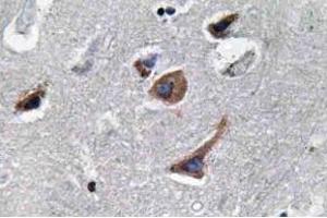 Immunohistochemistry (IHC) analyzes of IL-12A antibody in paraffin-embedded human brain tissue.