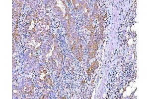 IHC analysis of RALBP1 using anti-RALBP1 antibody (ABIN7600800).