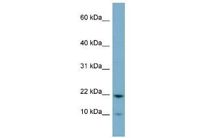 D15WSU75E antibody used at 1 ug/ml to detect target protein. (DESI1 antibody  (Middle Region))