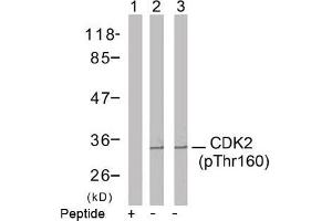 Image no. 2 for anti-Cyclin-Dependent Kinase 2 (CDK2) (pThr160) antibody (ABIN196845) (CDK2 antibody  (pThr160))