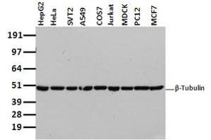 Image no. 2 for anti-Tubulin beta 4a (TUBB4A) antibody (ABIN1501580) (TUBB4 antibody)