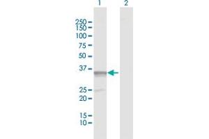 Western Blot analysis of PDXK expression in transfected 293T cell line by PDXK MaxPab polyclonal antibody. (PDXK antibody  (AA 1-312))