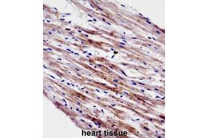 Immunohistochemistry (IHC) image for anti-Cardiotrophin 1 (CTF1) antibody (ABIN2998336) (Cardiotrophin 1 antibody)