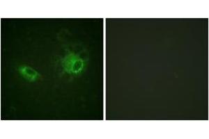 Immunofluorescence analysis of HeLa cells, using PDGFRB (Ab-1009) Antibody. (PDGFRB antibody  (AA 981-1030))