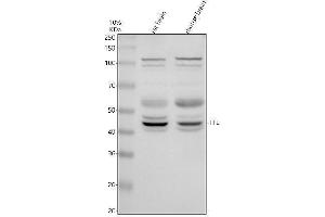Western blot analysis of TTL using anti-TTL antibody (ABIN7825998).