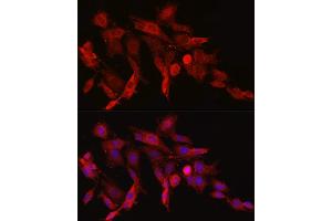 Immunofluorescence (IF) image for anti-Asparagine Synthetase (ASNS) (AA 262-561) antibody (ABIN6137209)