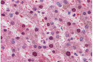 Human Liver: Formalin-Fixed, Paraffin-Embedded (FFPE) (RPS6KB1 antibody  (AA 490-502))