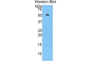 WB of Protein Standard: different control antibodies  against Highly purified E. (ANGPTL3 ELISA Kit)