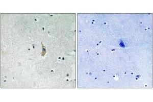 Immunohistochemistry analysis of paraffin-embedded human brain tissue, using PSEN1 (Ab-357) Antibody. (Presenilin 1 antibody  (AA 323-372))