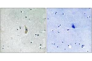Immunohistochemistry analysis of paraffin-embedded human brain tissue, using PSEN1 (Ab-357) Antibody.