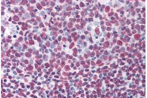 Human Tonsil: Formalin-Fixed, Paraffin-Embedded (FFPE) (KHSRP antibody  (AA 151-240))