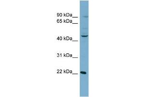 WB Suggested Anti-GOT1 AntibodyTitration: 1 µg/mL  Positive Control: NCI-H226 Whole Cell  GOT1 is supported by BioGPS gene expression data to be expressed in NCIH226 (GOT1 antibody  (N-Term))