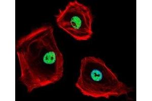 Fluorescent confocal image of SK-BR-3 cells stained with CTBP1 antibody. (CTBP1 antibody  (AA 413-440))
