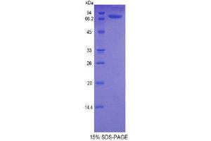 SDS-PAGE (SDS) image for Deiodinase, Iodothyronine, Type II (DIO2) (AA 30-259) protein (His tag,MBP tag) (ABIN1079363)