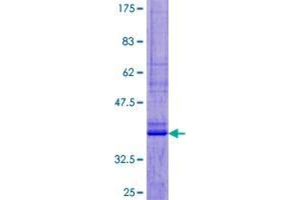 Urocortin 2 Protein (UCN2) (AA 1-112) (GST tag)