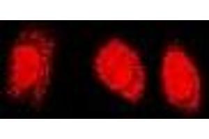 Immunofluorescent analysis of PSMC4 staining in U2OS cells. (PSMC4 antibody)