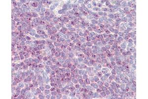Anti-DLL1 antibody IHC of human spleen. (DLL1 antibody  (AA 640-700))