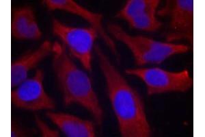 Immunofluorescence staining of methanol-fixed Hela cells using synapsin(Phospho-Ser9) Antibody. (SYN1 antibody  (pSer9))