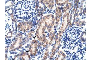 Image no. 1 for anti-RB-Associated KRAB Zinc Finger (RBAK) (AA 447-496) antibody (ABIN6735905) (RBAK antibody  (AA 447-496))