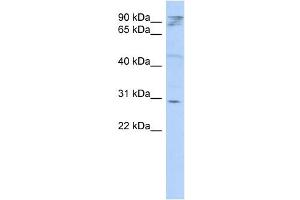 WB Suggested Anti-HAX1 Antibody Titration: 0.