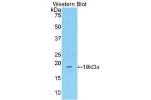 Western Blotting (WB) image for anti-Mannose Associated Serine Protease 2 (AA 280-433) antibody (ABIN1859764) (Mannose Associated Serine Protease 2 (AA 280-433) antibody)