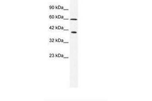 Image no. 1 for anti-Minichromosome Maintenance Complex Component 7 (MCM7) (N-Term) antibody (ABIN203097) (MCM7 antibody  (N-Term))