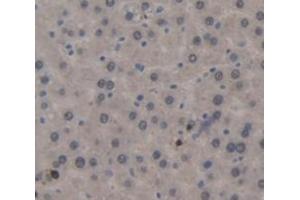 IHC-P analysis of Rat Tissue, with DAB staining. (CD11b antibody  (AA 31-160))