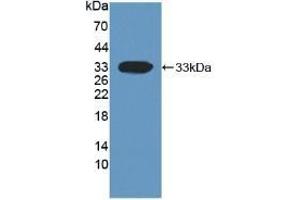 Detection of Recombinant DKK1, Human using Monoclonal Antibody to Dickkopf Related Protein 1 (DKK1) (DKK1 antibody  (AA 33-266))