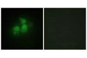 Immunofluorescence analysis of HepG2 cells, using IPPK antibody. (IPPK antibody)