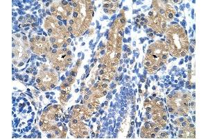 HSD17B1 antibody was used for immunohistochemistry at a concentration of 4-8 ug/ml to stain Epithelial cells of renal tubule (arrows) in Human Kidney. (HSD17B1 antibody)