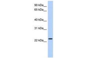 Image no. 1 for anti-Activating Transcription Factor 3 (ATF3) (AA 71-120) antibody (ABIN6740496) (ATF3 antibody  (AA 71-120))