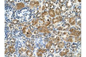 Immunohistochemistry (IHC) image for anti-Cystatin B (Stefin B) (CSTB) (Middle Region) antibody (ABIN2782349) (CSTB antibody  (Middle Region))
